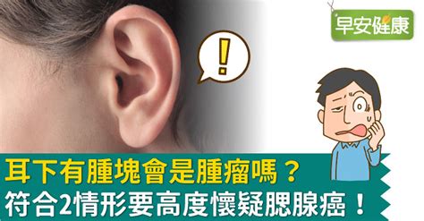 耳垂腫起來|耳垂下的疼痛與腫塊：該看哪位醫生？